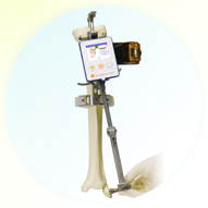 Knee Align 2 system