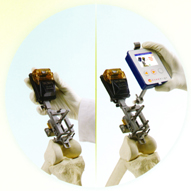 Knee Align 2 system